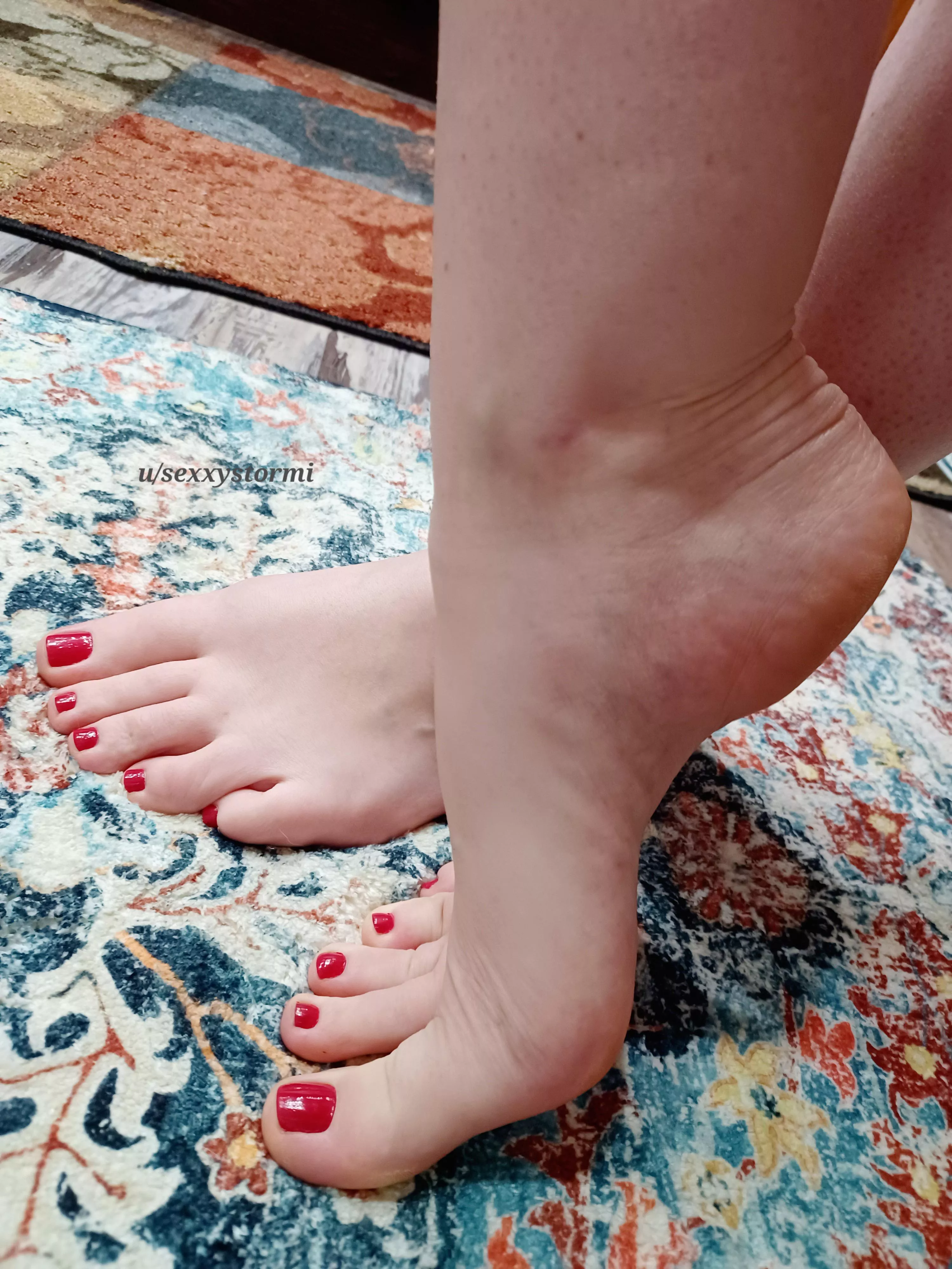 Wish you were here to cover them in kisses posted by sexxystormi