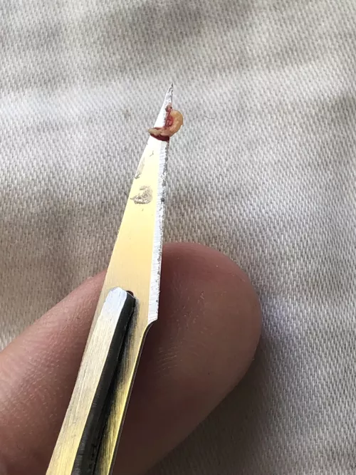 First post as a lurker, this silly little thing has been brewing for years now. Right under my left nostril by gemstonepotato