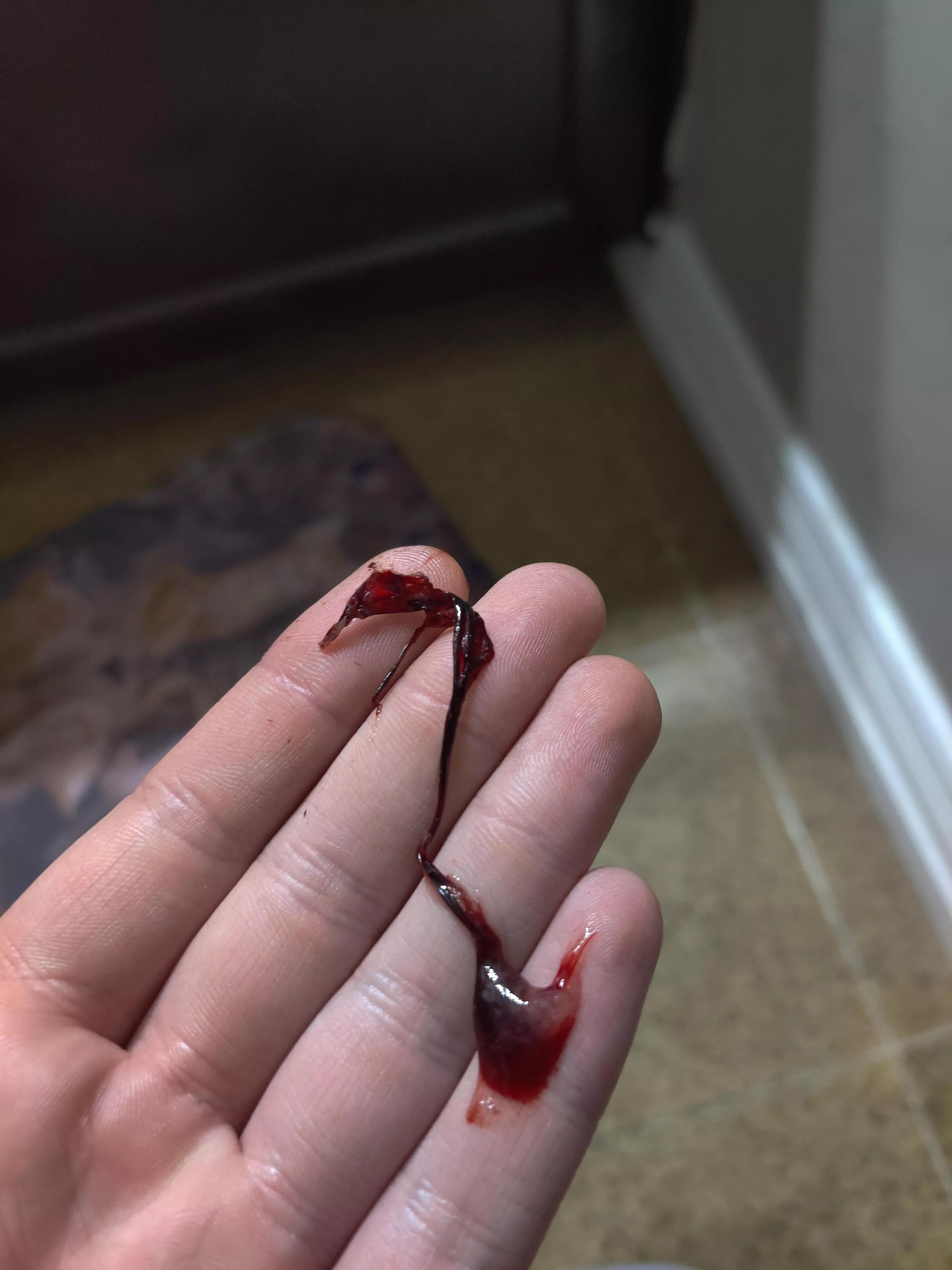 Nose bled while I was asleep and I pulled this unholy thing out when I woke up. It's about 4 inches long posted by zephyrosity
