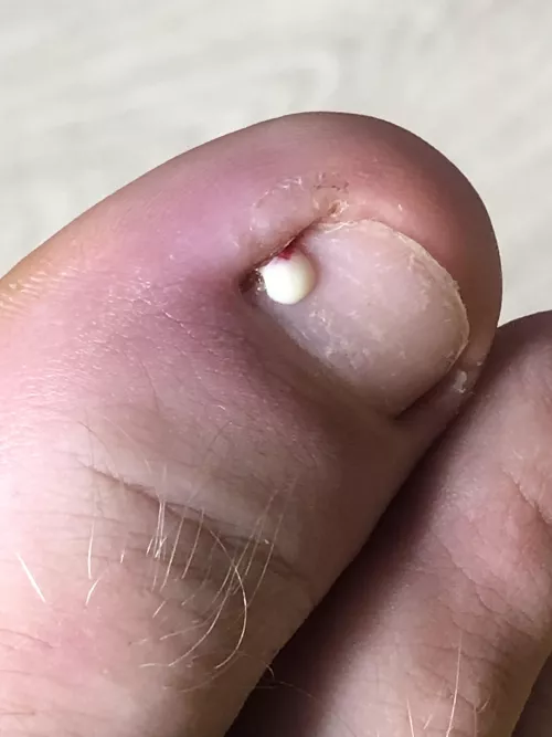 It popped super fast I didnt expect it by GlueBuddha