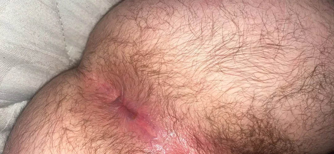 Who would put it in my tight hole ? by James_motherwell