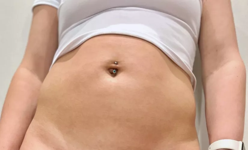 35F tummy in a white crop top :) by newtothegame1987