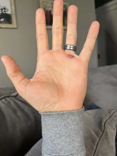 [forbidden pop] I can feel it pulse with every heartbeat by DiepSleep