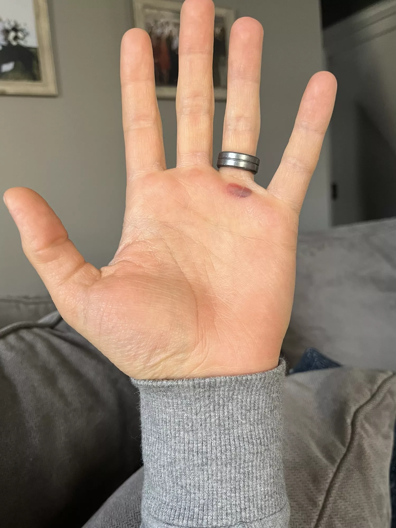 [forbidden pop] I can feel it pulse with every heartbeat posted by DiepSleep