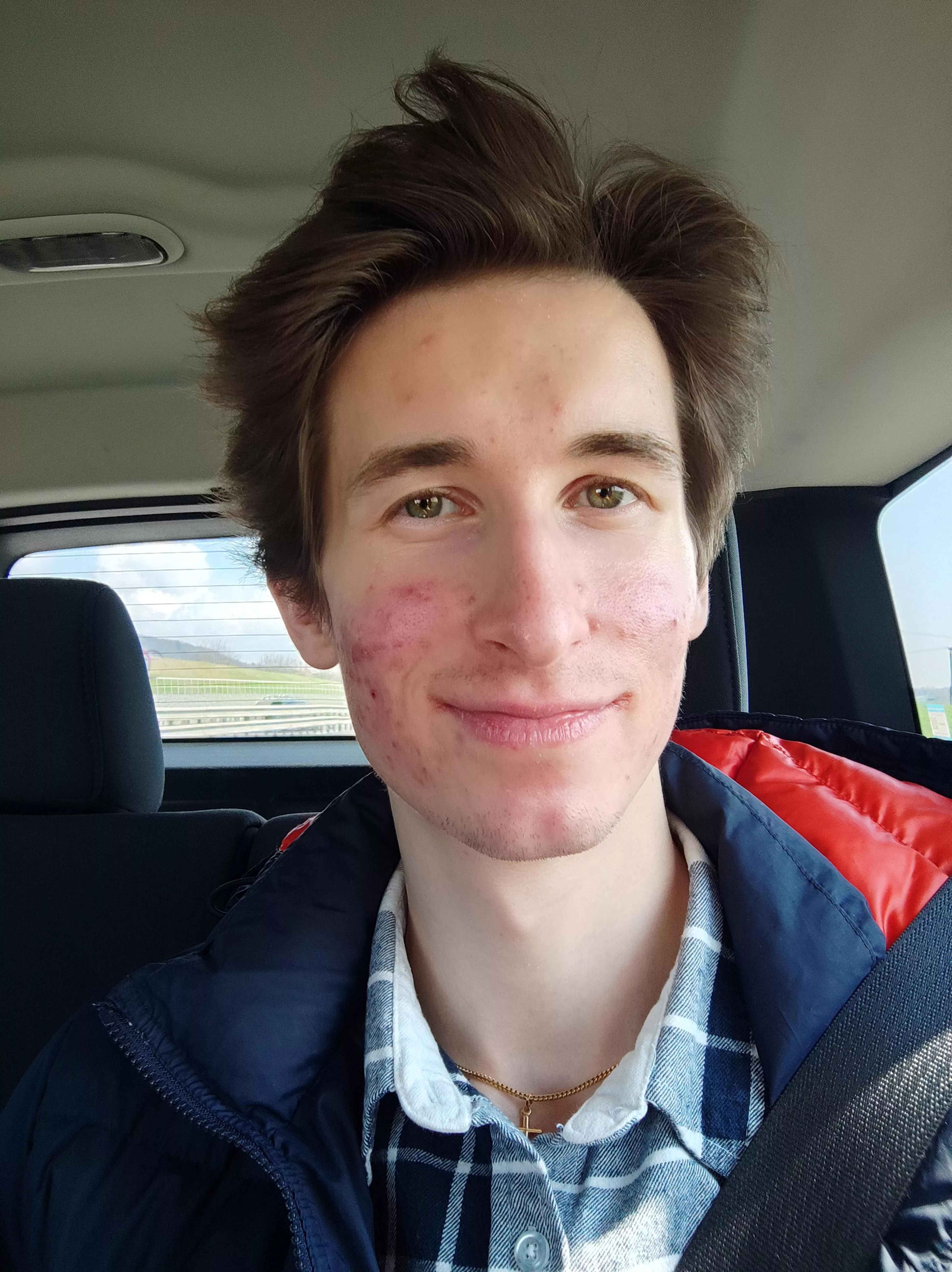 Happy Easter Monday 💙 2 months on acne treatment and it keeps getting better posted by kubapp21