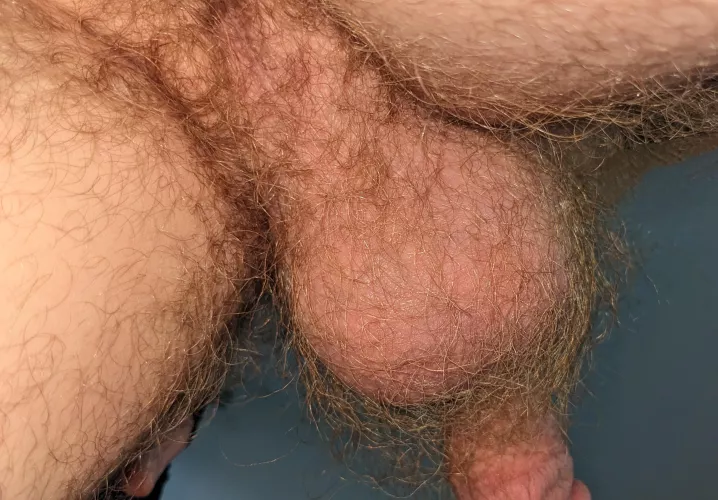 Would you say my taint and balls qualify as insanely hairy? by responsive-banana