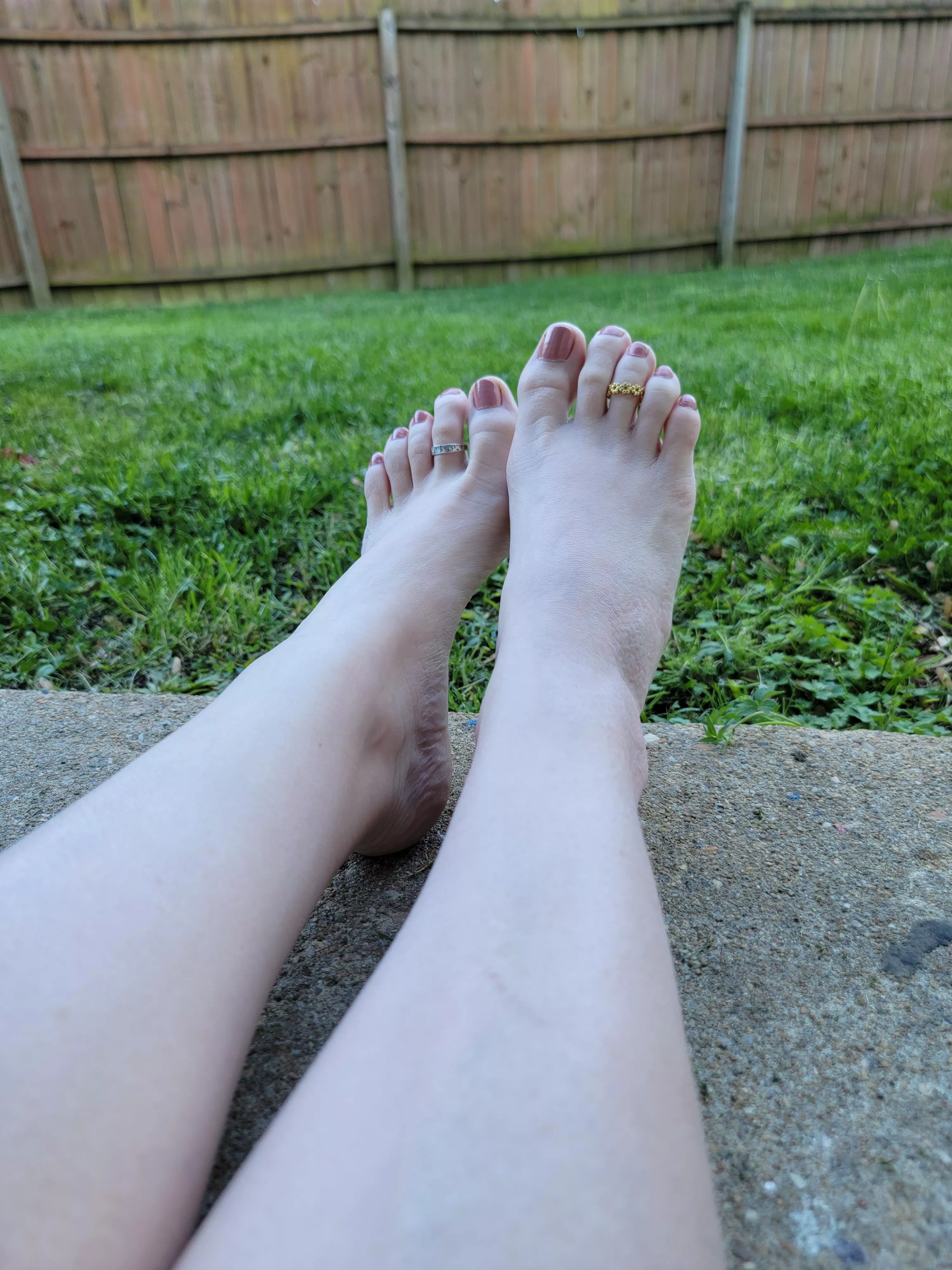 I like the pink on my pale feet posted by Ok_Lychee_3577