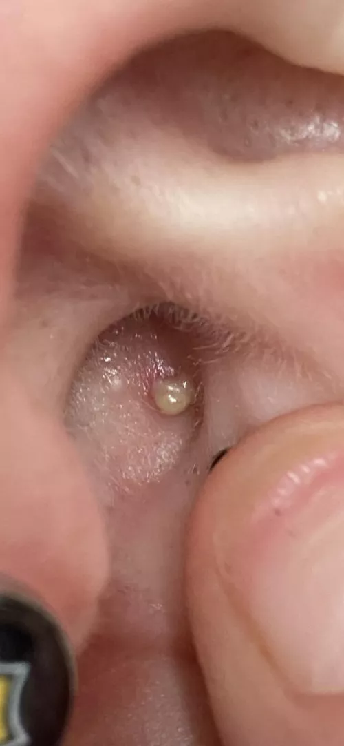 Inner Ear - felt something inside by ReddUp412