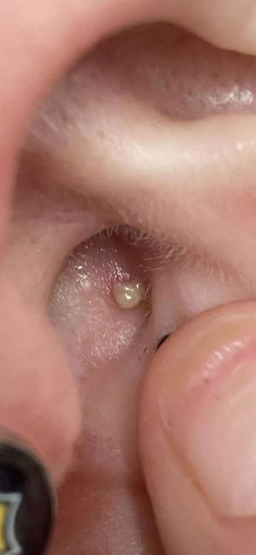 Inner Ear - felt something inside posted by ReddUp412