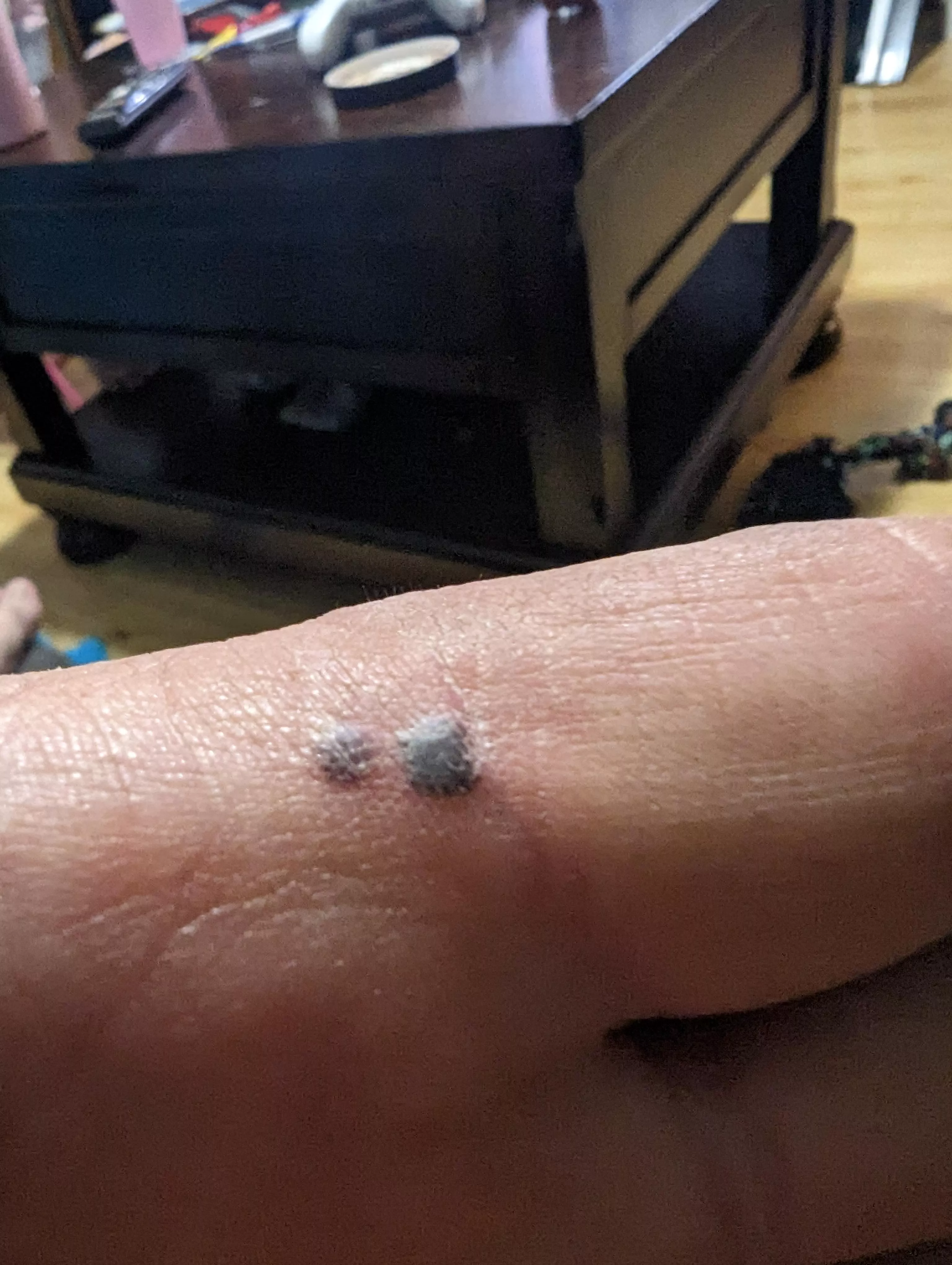 It's not tire season until you get yourself with the weight hammer. posted by wrenchindaddy802