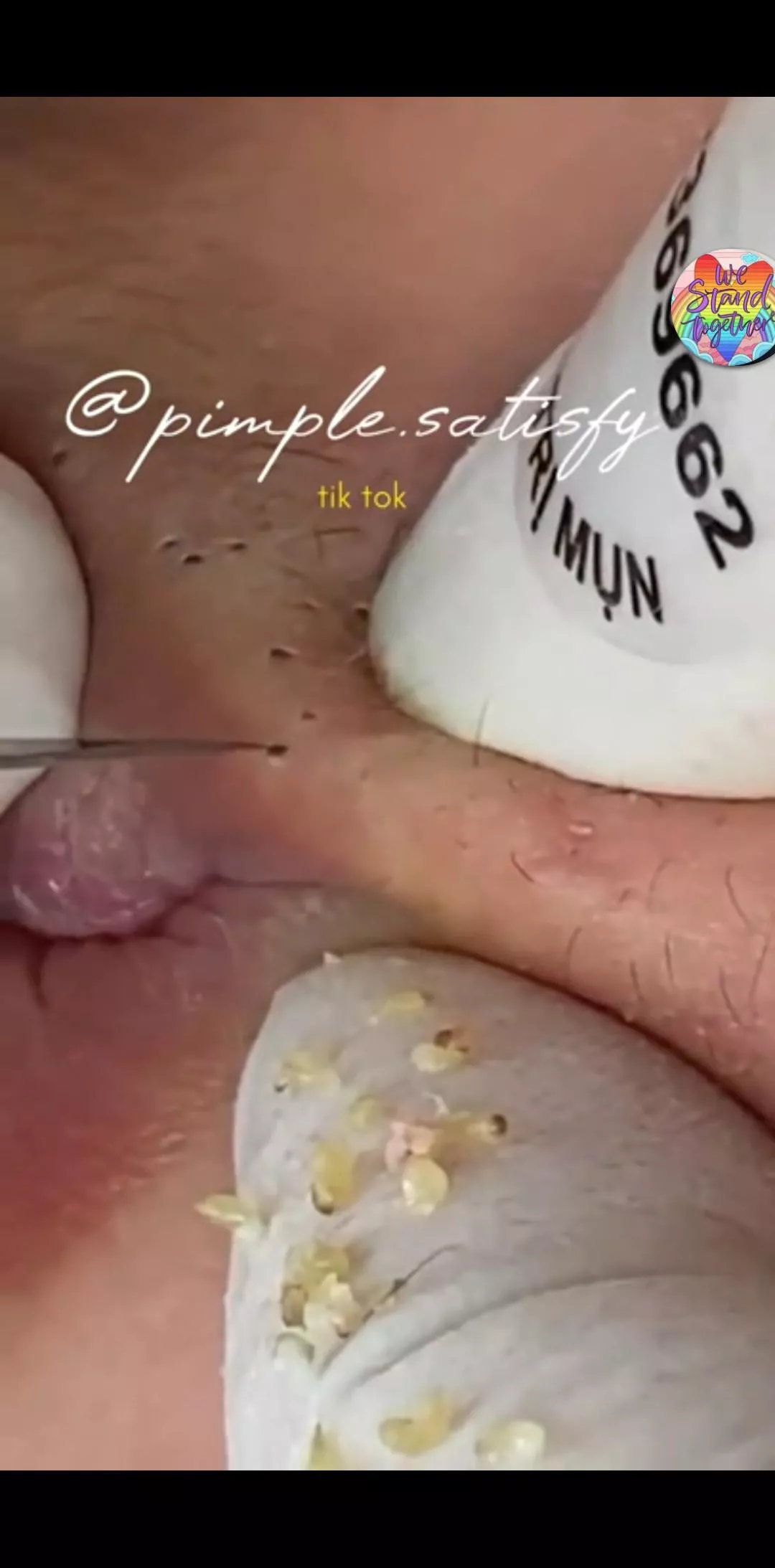 Does anybody actually like it when places wipe all the contents on a glove/gauze or even leave them on the skin so their visible? posted by chonk_fox89