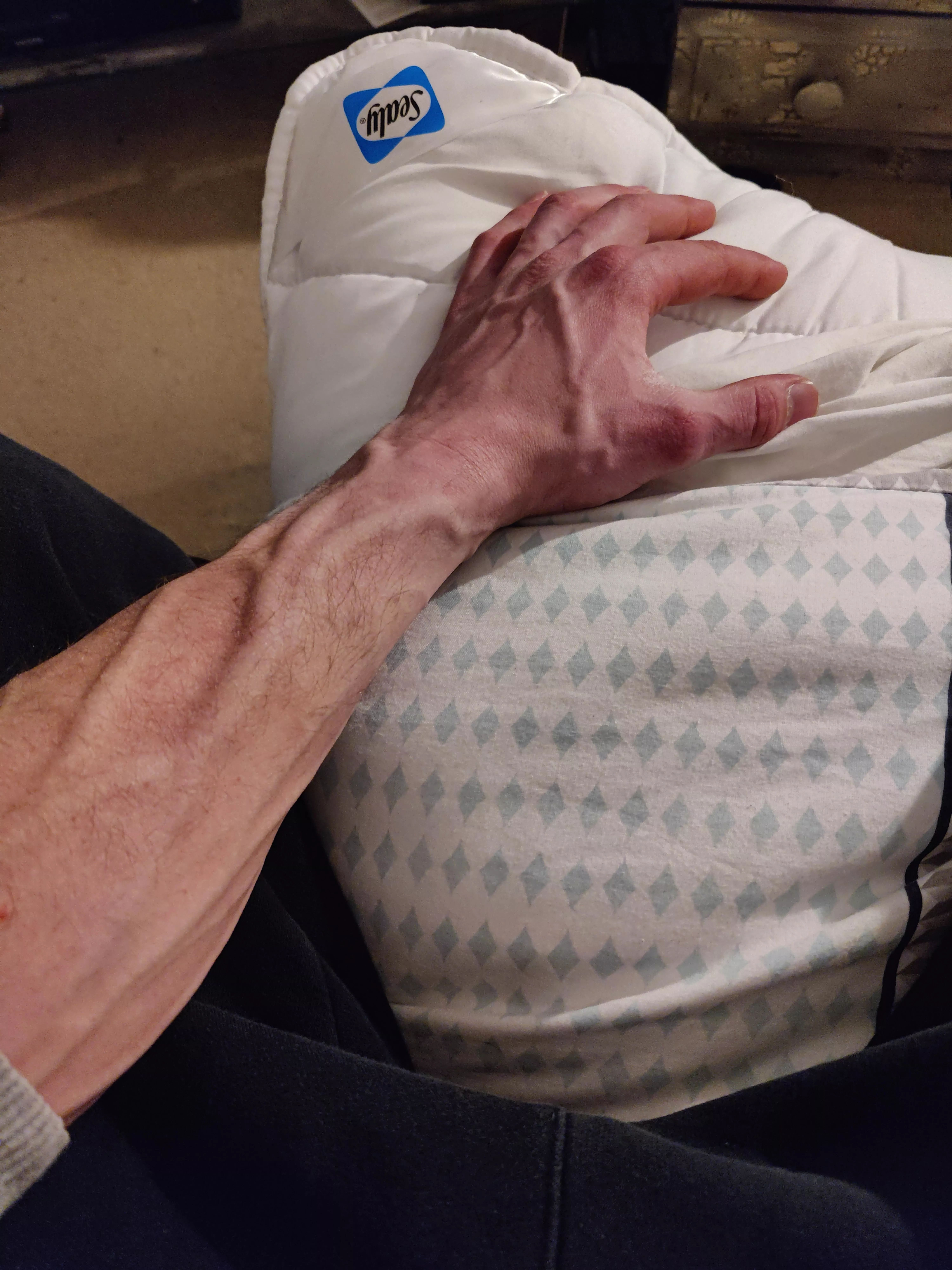 Forearm/hand stoof posted by MyFingerYourBum