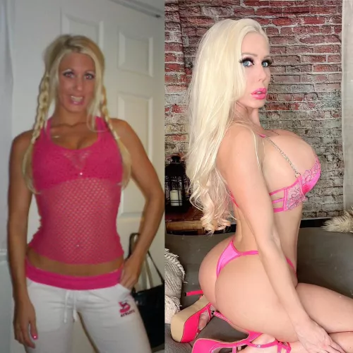 From b cup to DDD 1150cc and now healing from my new 1500cc. Plastic is fantastic by Curvy-jenna