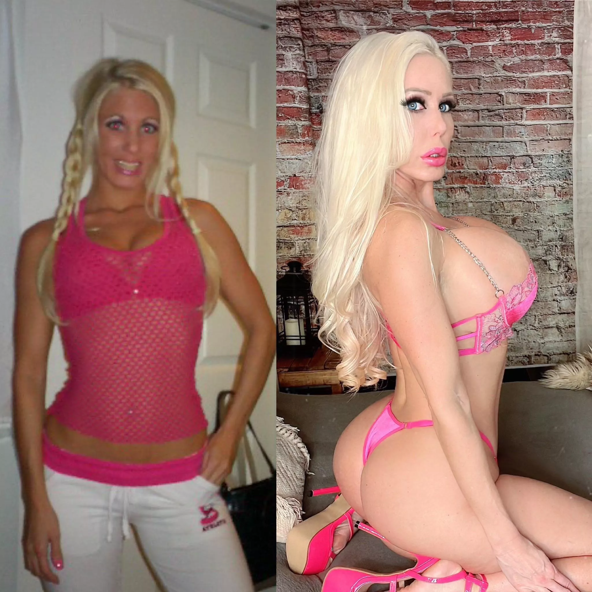 From b cup to DDD 1150cc and now healing from my new 1500cc. Plastic is fantastic posted by Curvy-jenna