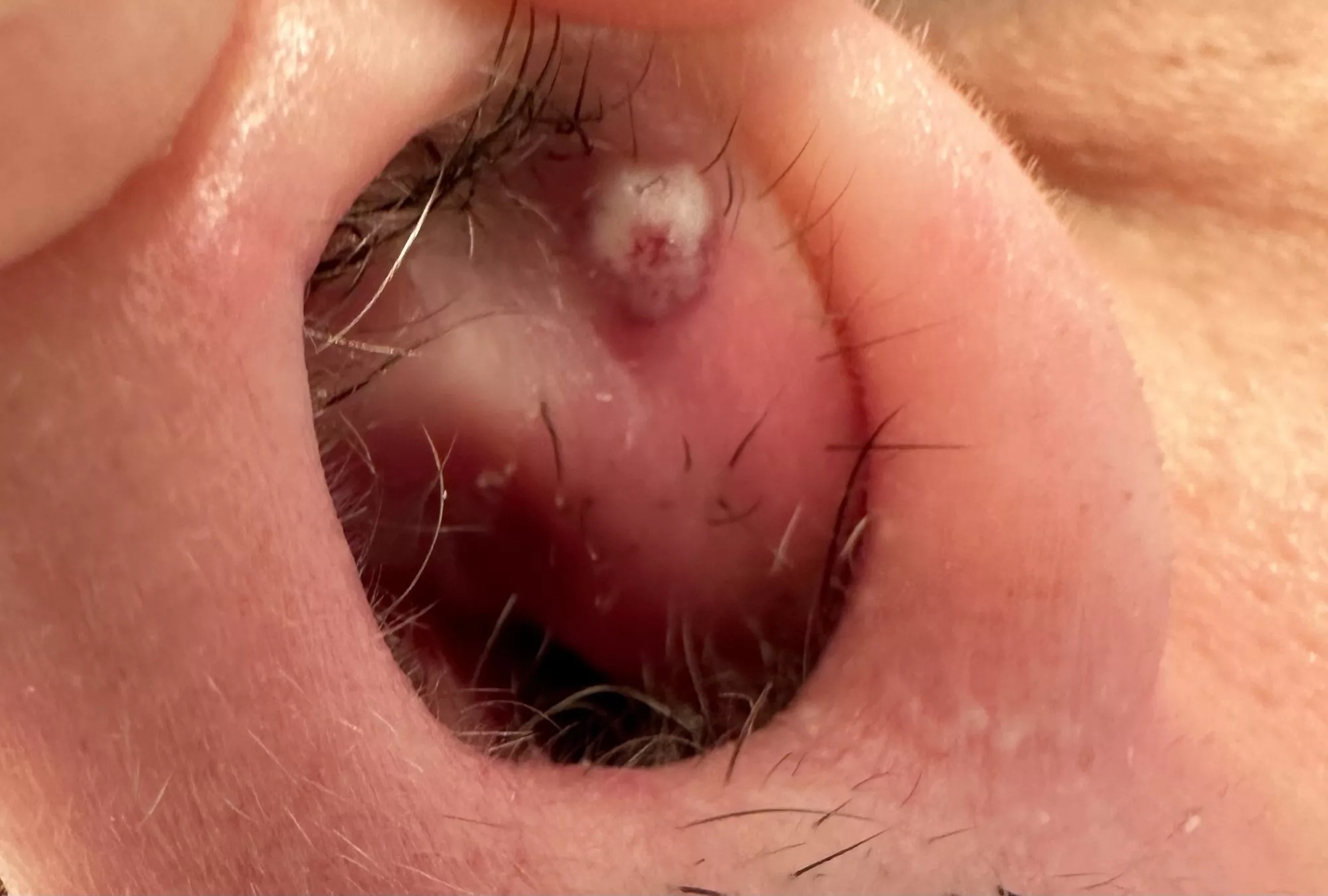 Woke up to this beast in my nostril posted by twisty_passages