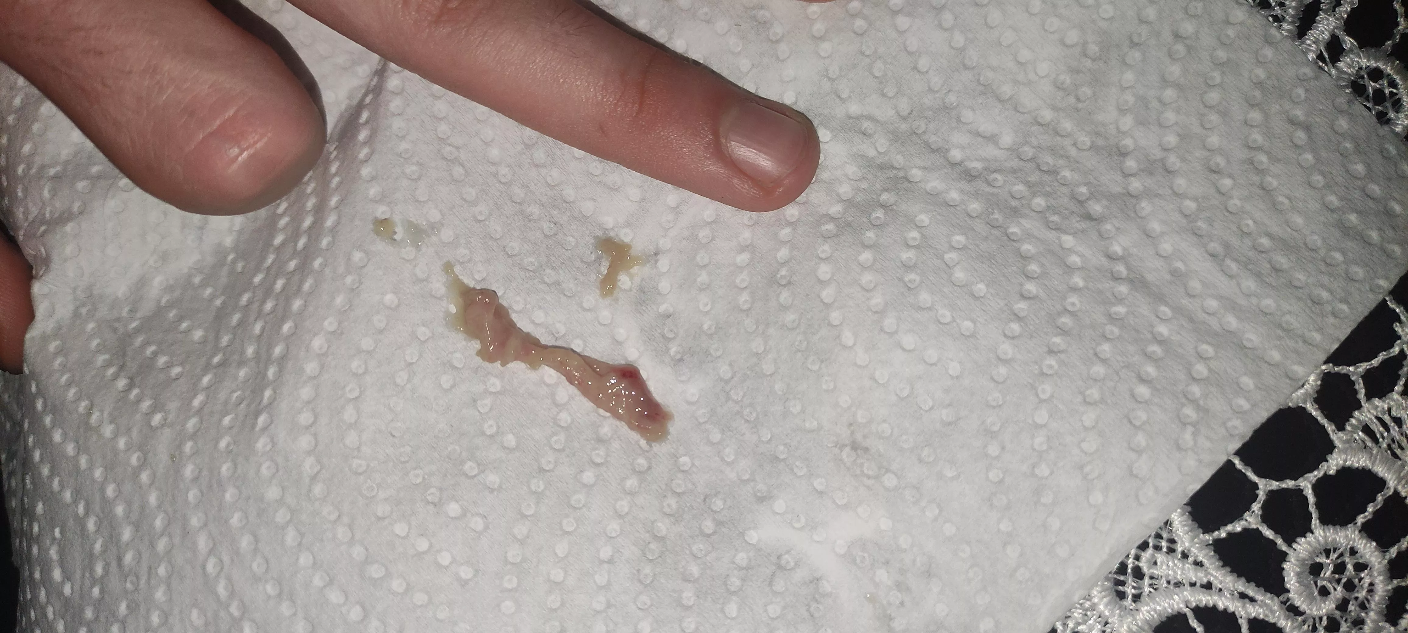 What even is this thing that came out of my nose (41° fever) posted by VoicePlenty3750