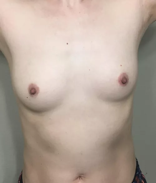 40F/125lbs/5’6” Asian mom feeling uncertain by KimchiBanana4321