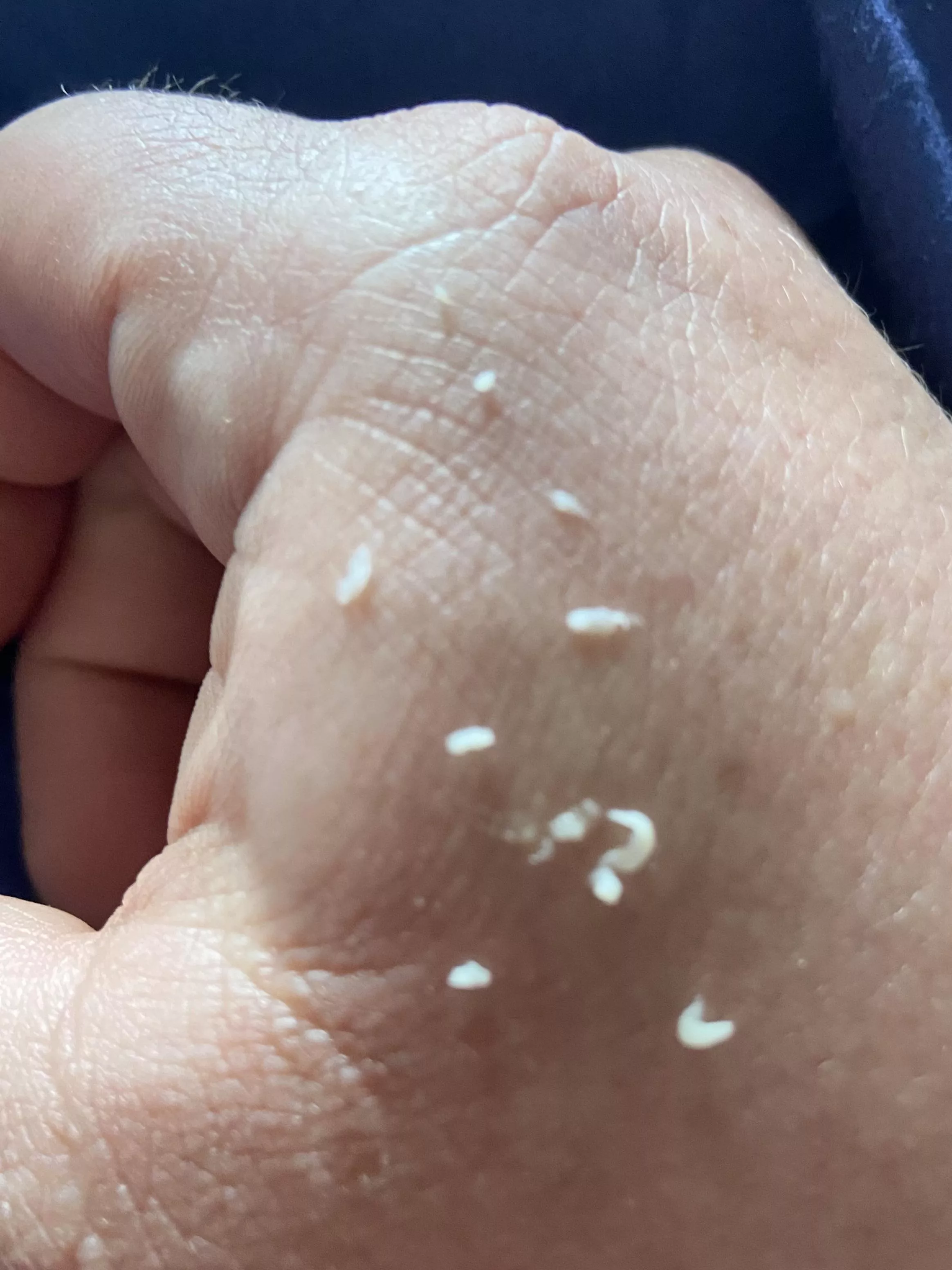 One of my nipples hurt and I squeezed so much out. posted by catbehindbars