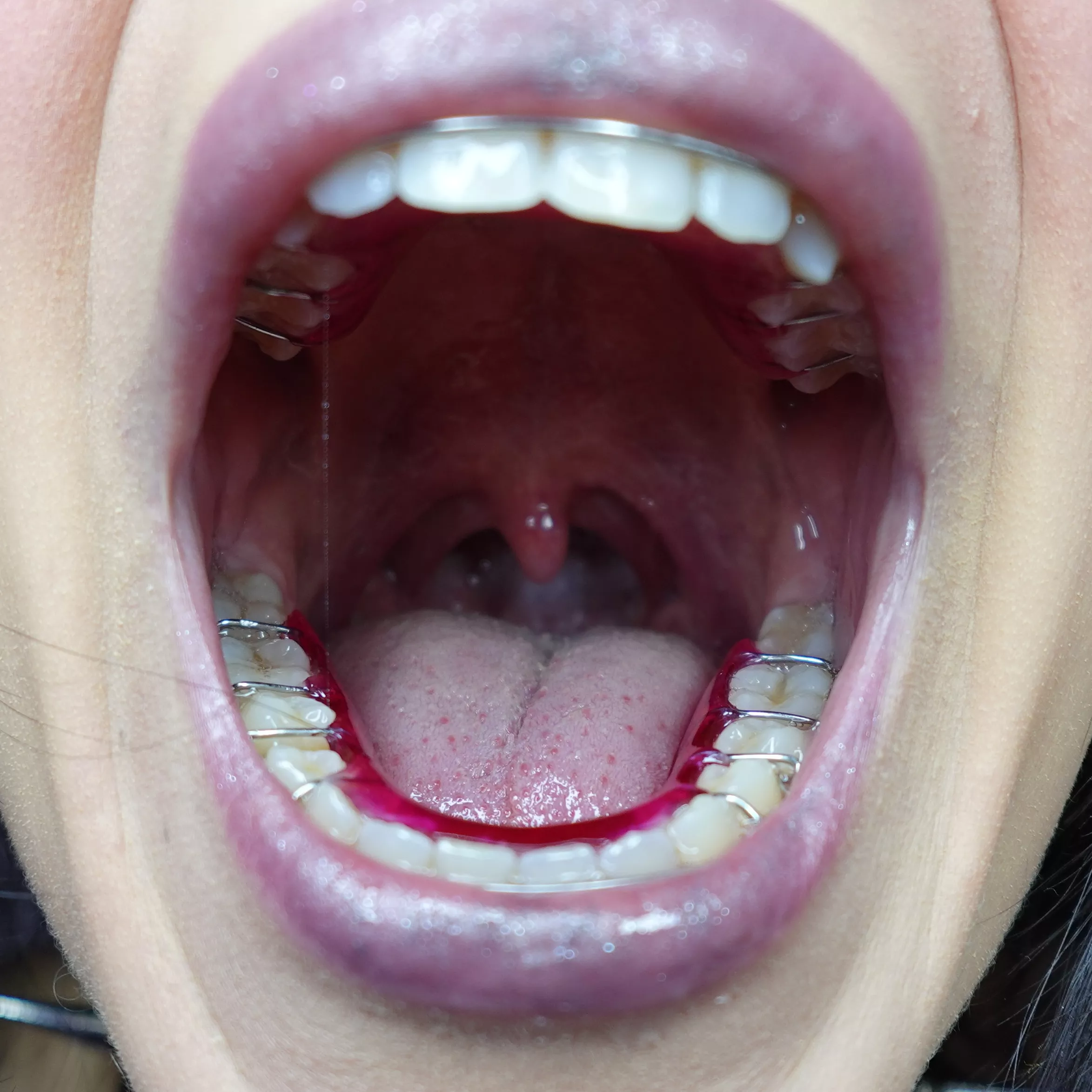 Is my uvula big? posted by saphira_asmr