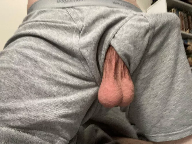 Oops they fell out by V3ntchr1s