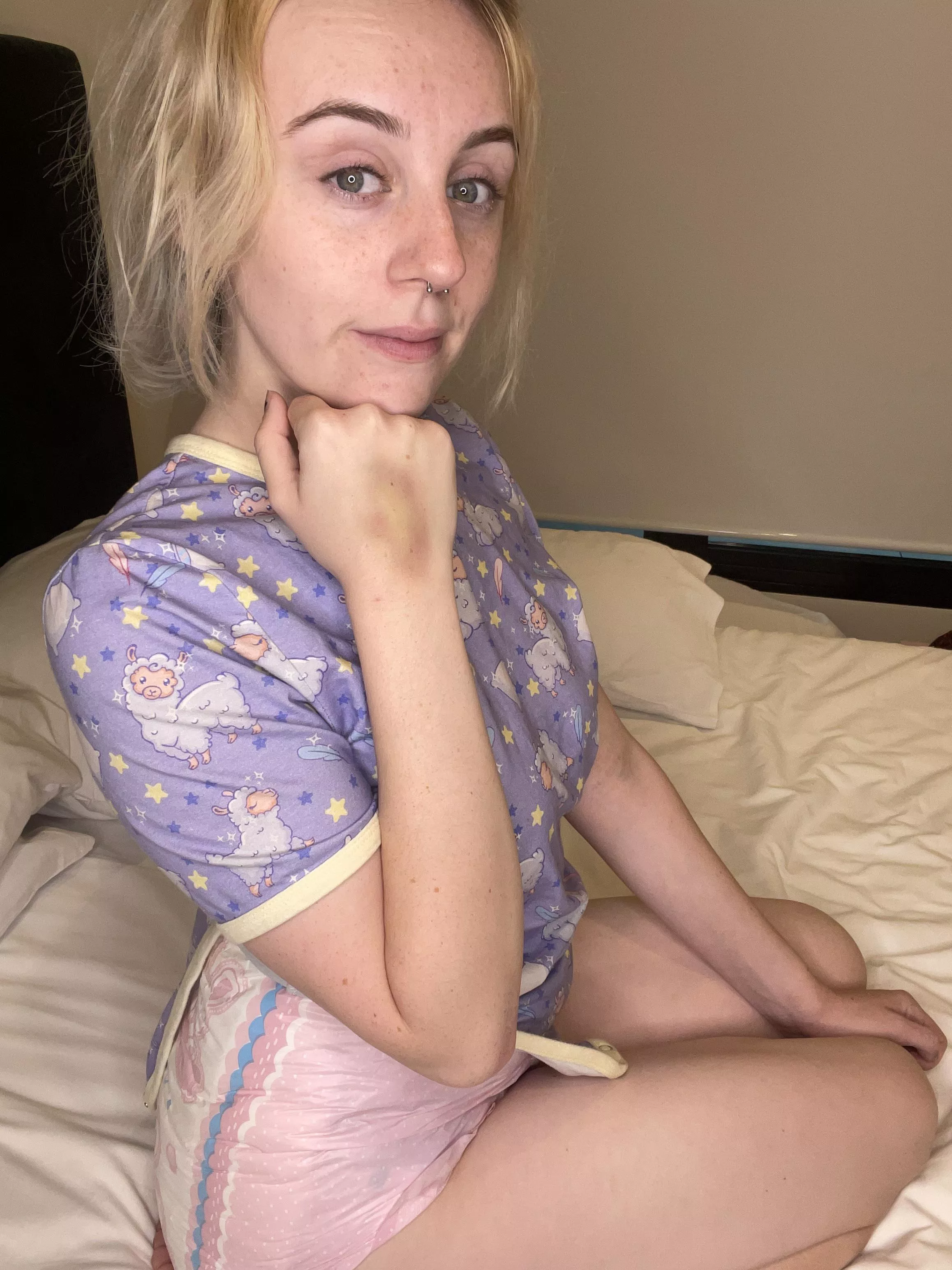 I have bruise 😭 maybe daddy can help me feel better? 🥺🥺💕 posted by xlittlelucyx