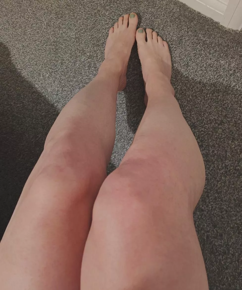 My little legs n feets 🥰 posted by WelcomTraveller