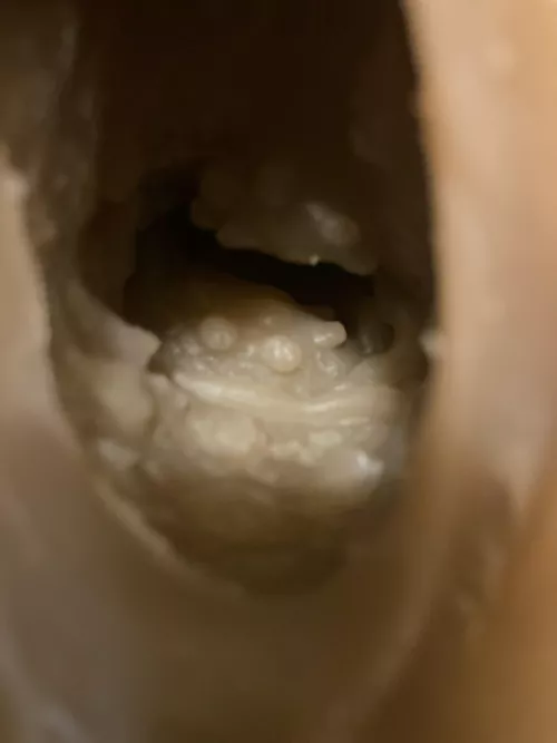 How to smooth out these vagina bumps? Can’t find any videos on a heating rod to the vagina/anal. by Rare-Flight3725