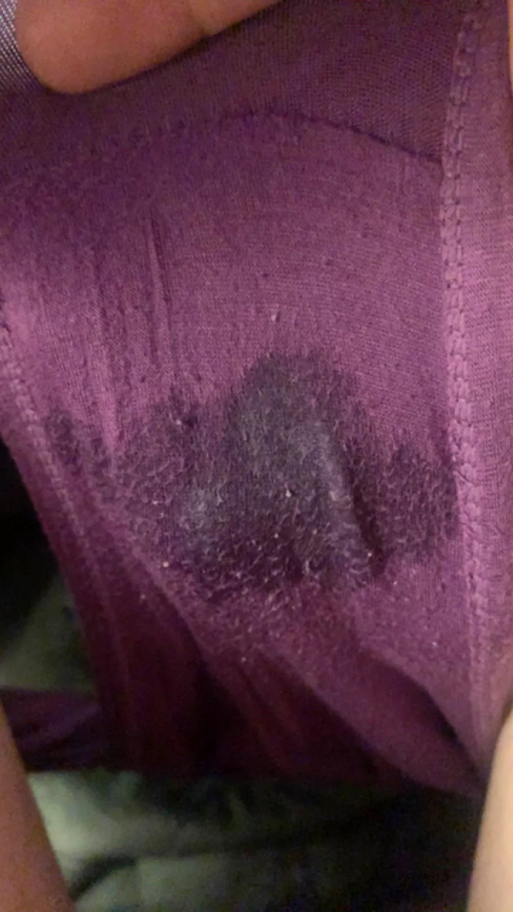 Woke up like this after fun last night.. posted by anakenob