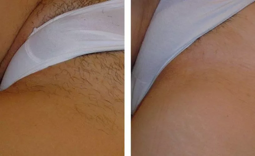 There’s a hairy prize under my panties. 😉 by gowigowi