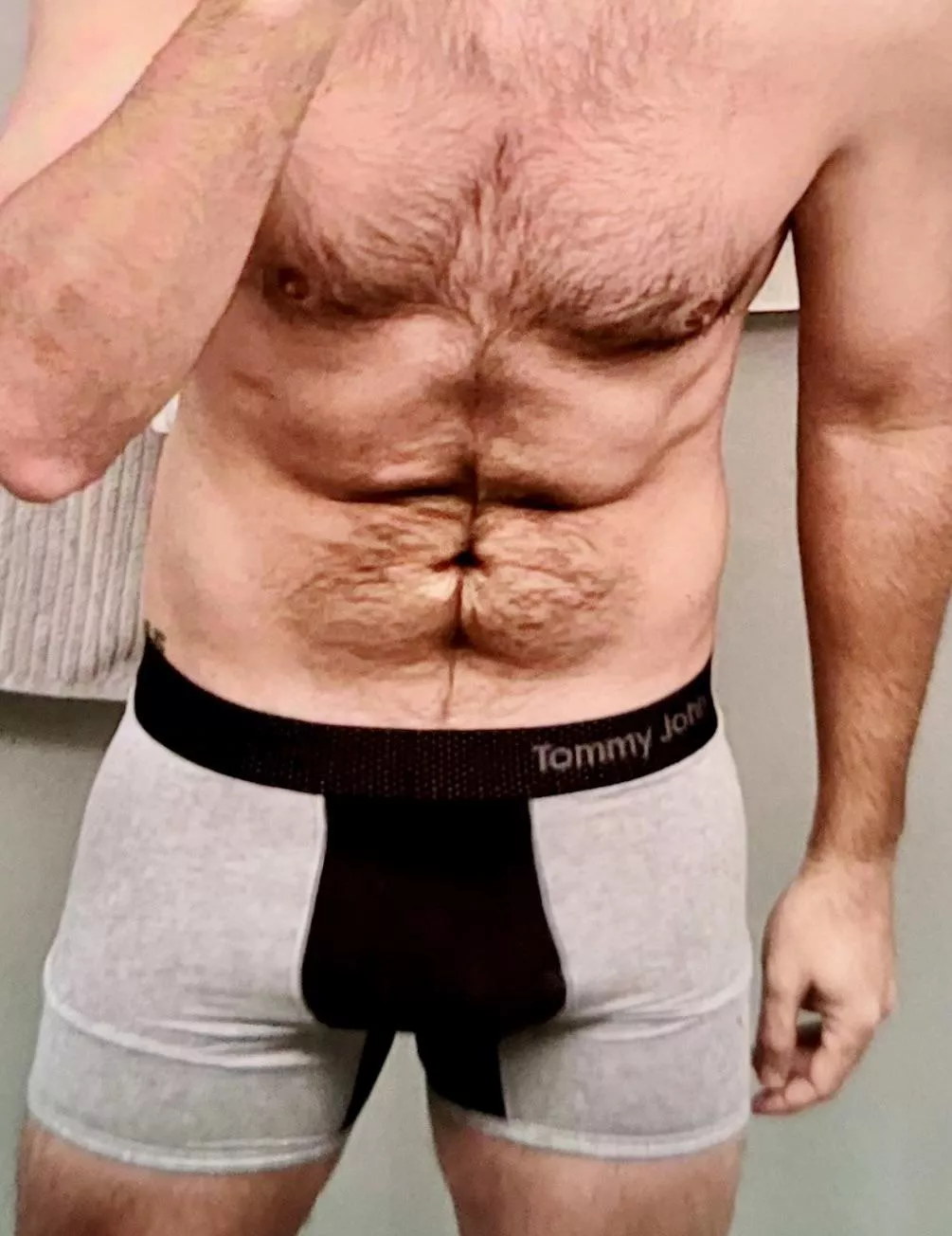 Tommy John posted by Justdickinaroundhere