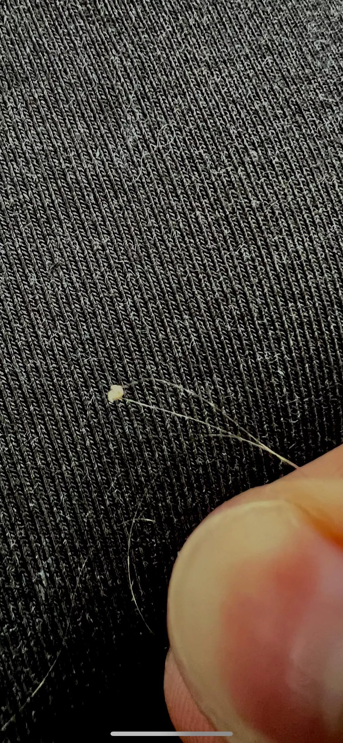 Deep cystic sit i’ve been digging my at in back of my head for 2.5 weeks posted by harbulary_Batteries_