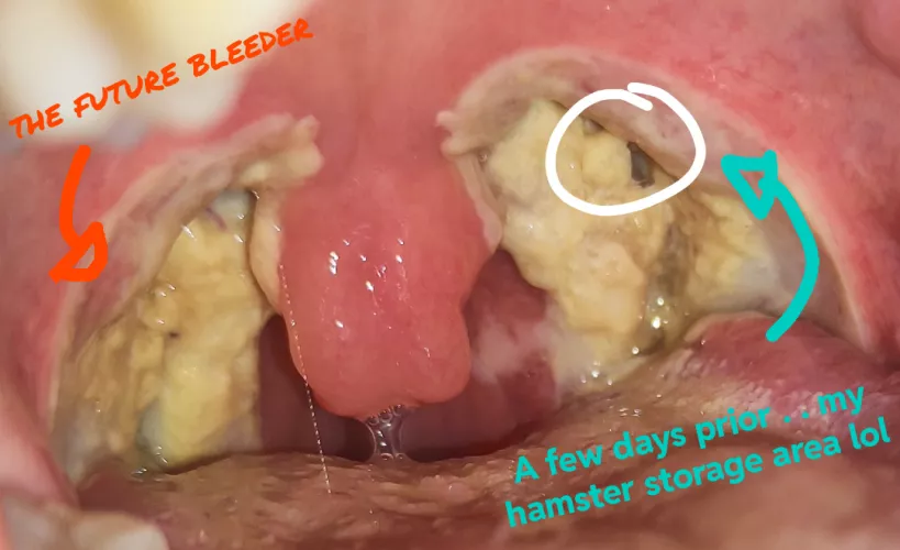 Don't laugh too hard at your own joke, a cautionary tale. by Akiine