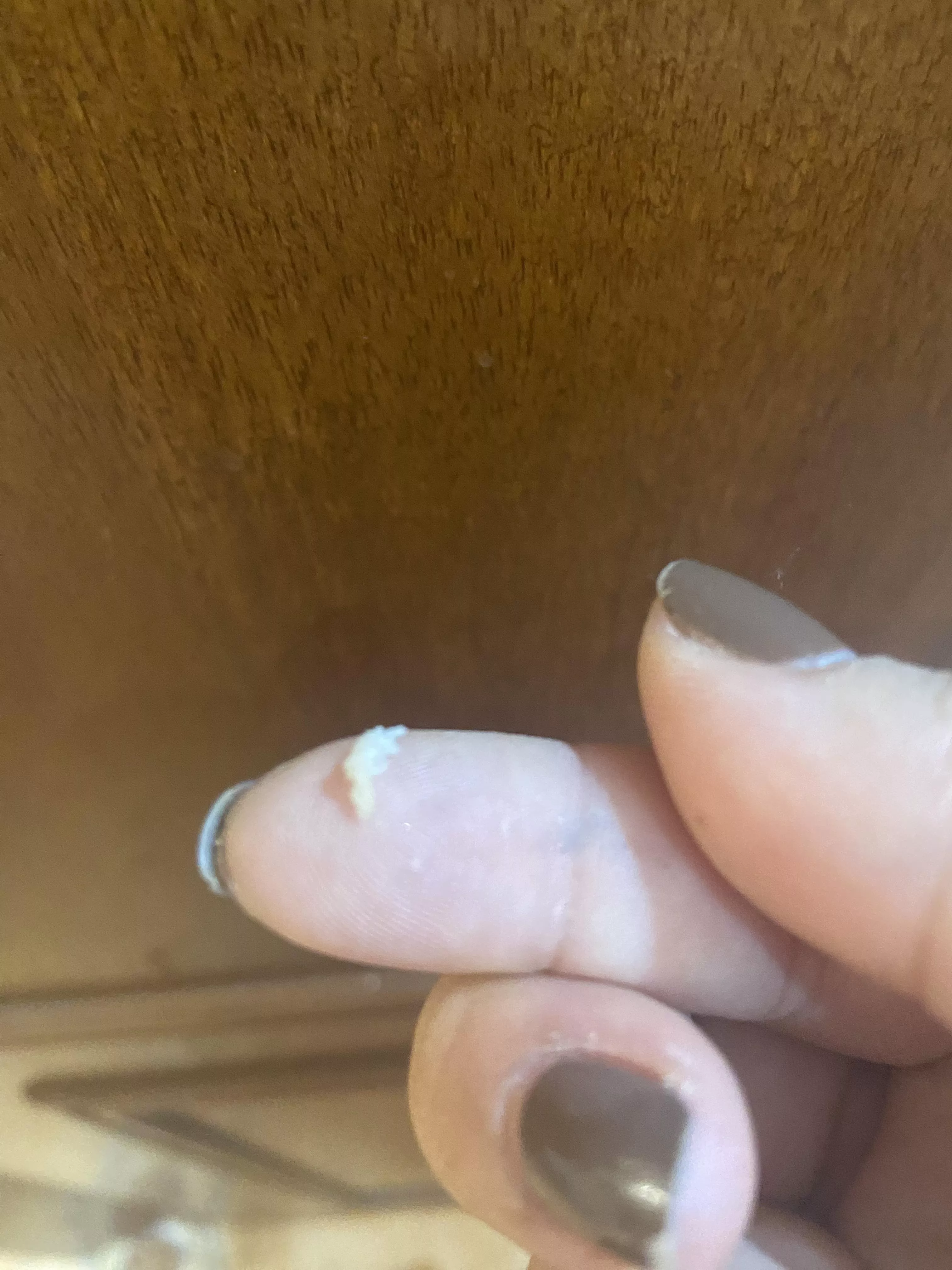 Follow up to my last post. I es making sure I didn’t leave anything in. I think I got it all (a bit more came out, including the sack, I think) posted by nicksbrunchattiffany