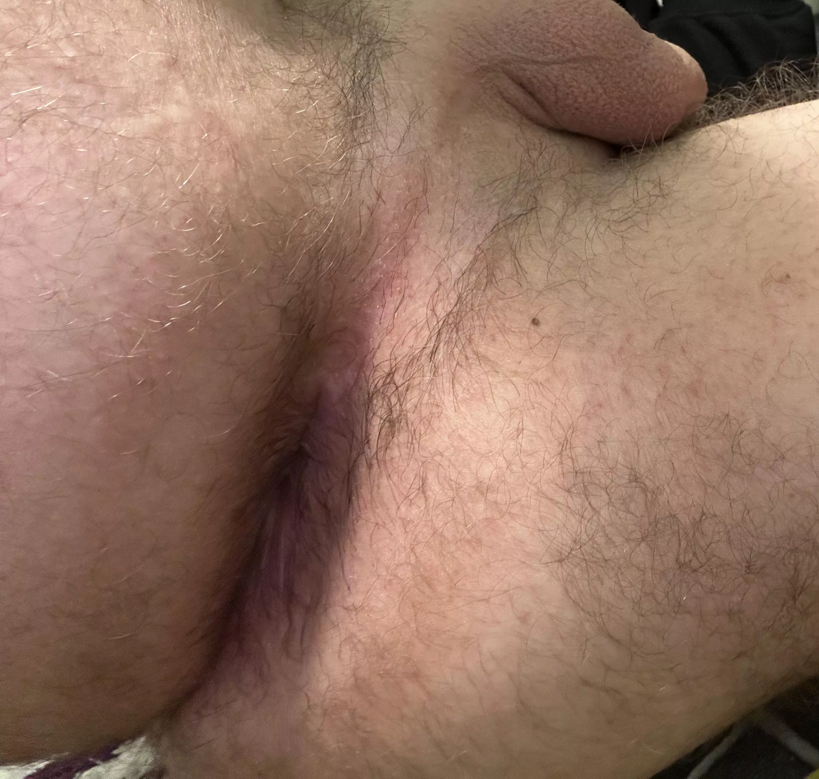 Look how hairy it is posted by kacgod5