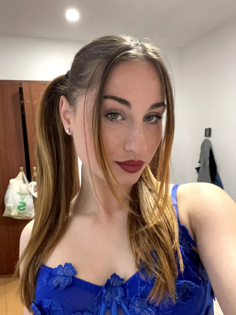 My freckles make me sexier by RadiantIncomes