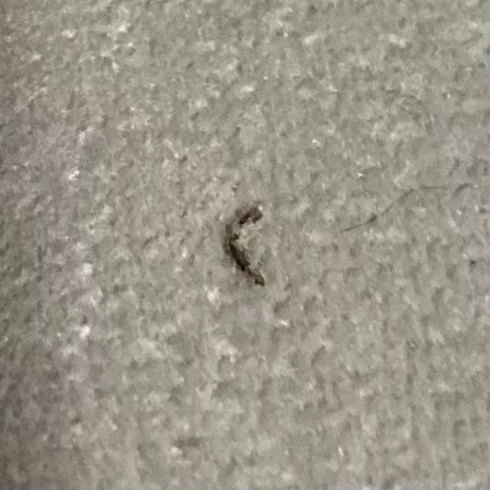 [PIC] i had this annoying thing in my leg for weeks until I decided to try popping it. Sorry for no video posted by llemonjuiice