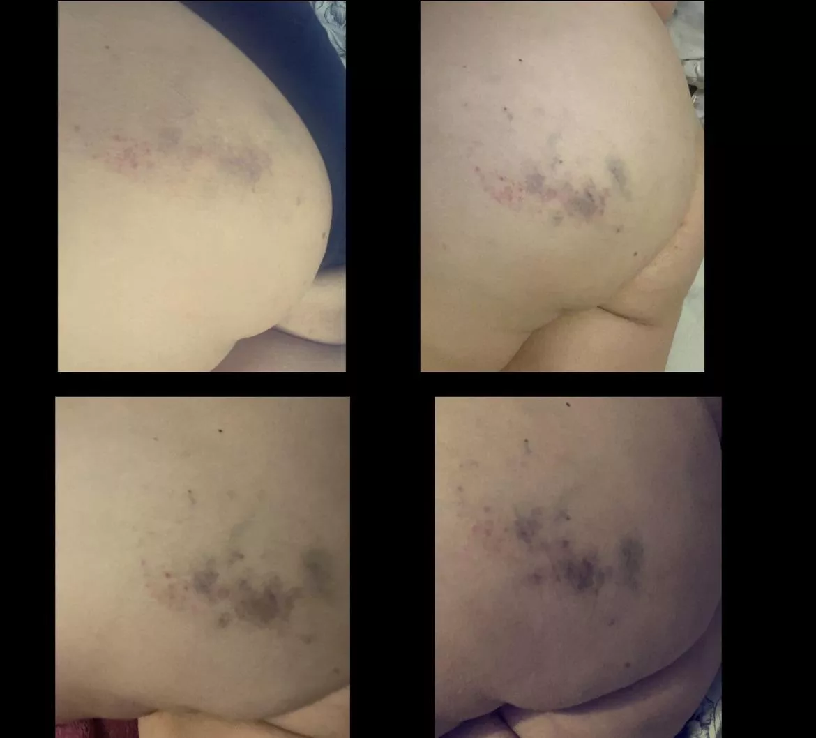 Getting better everyday. Thank you for my beating Daddy posted by Wolfandprincess