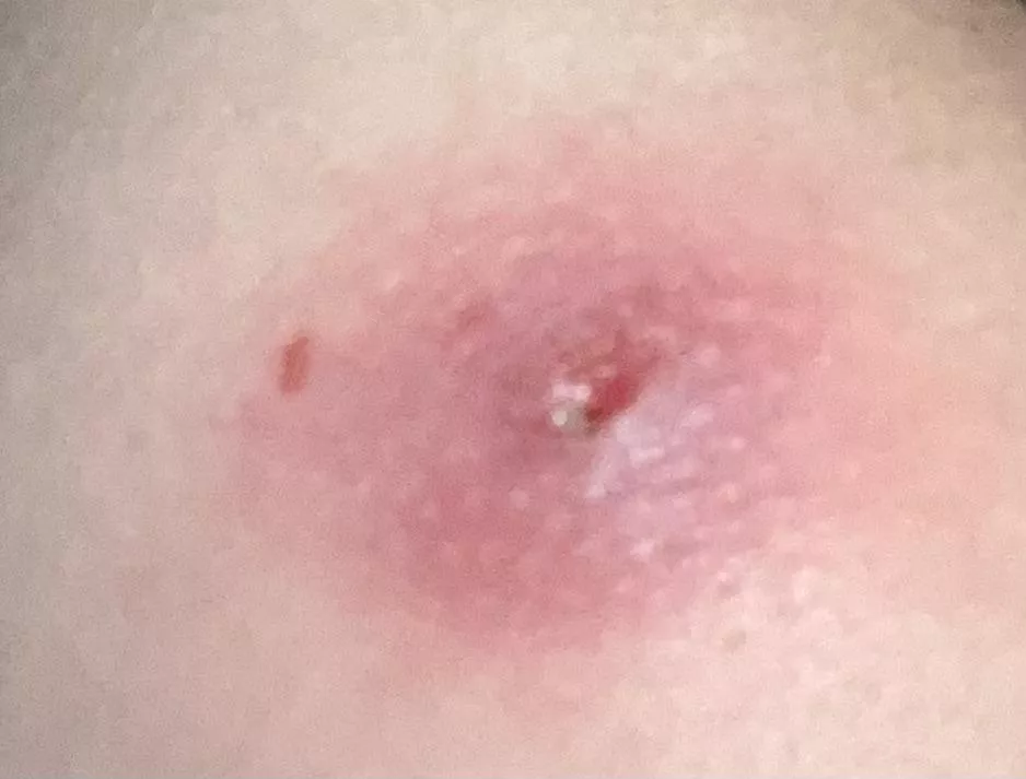 My asscheek hurts (help) posted by Leaked99