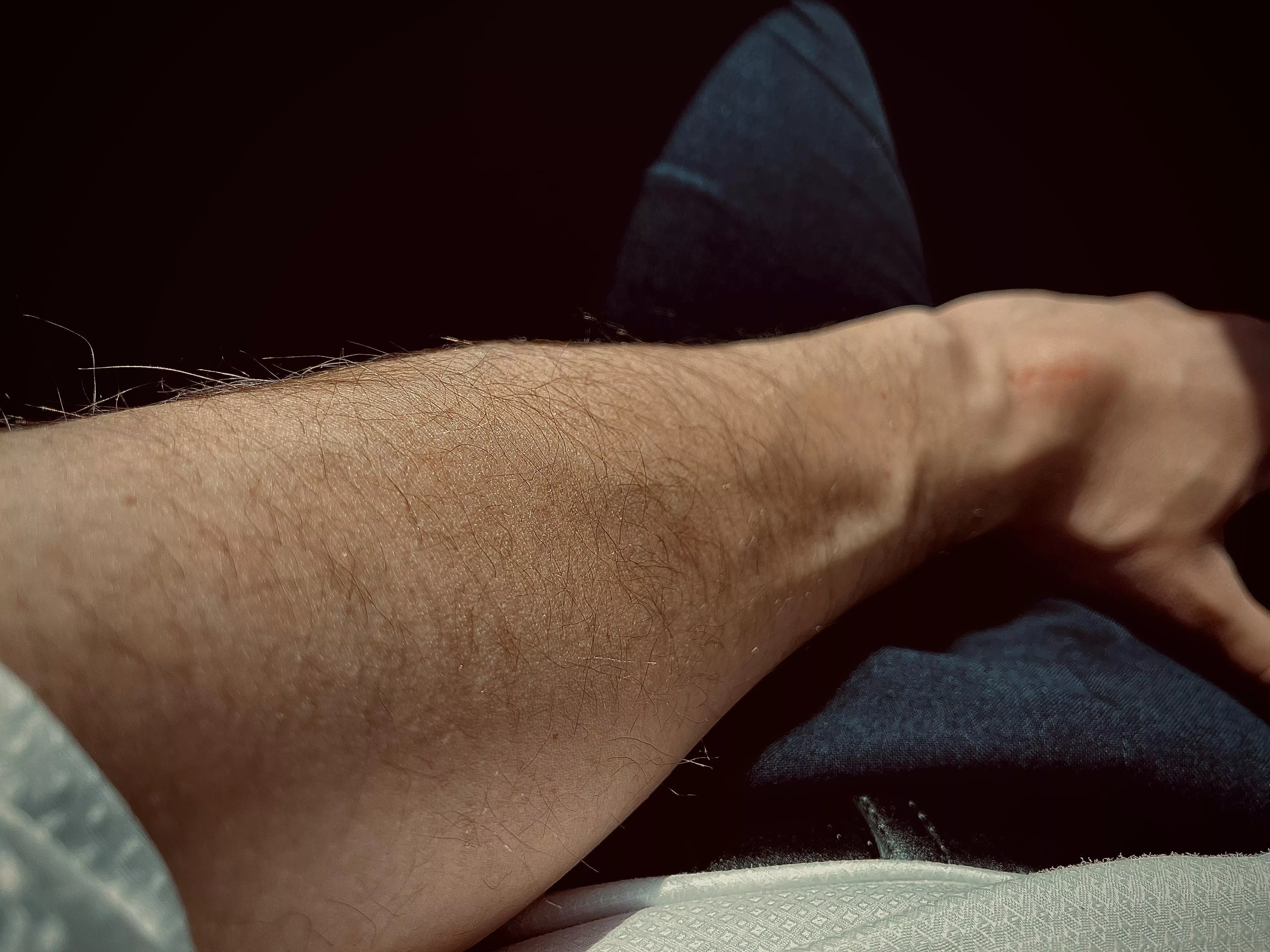 When light hit the skin.. posted by TheManOnSuit1