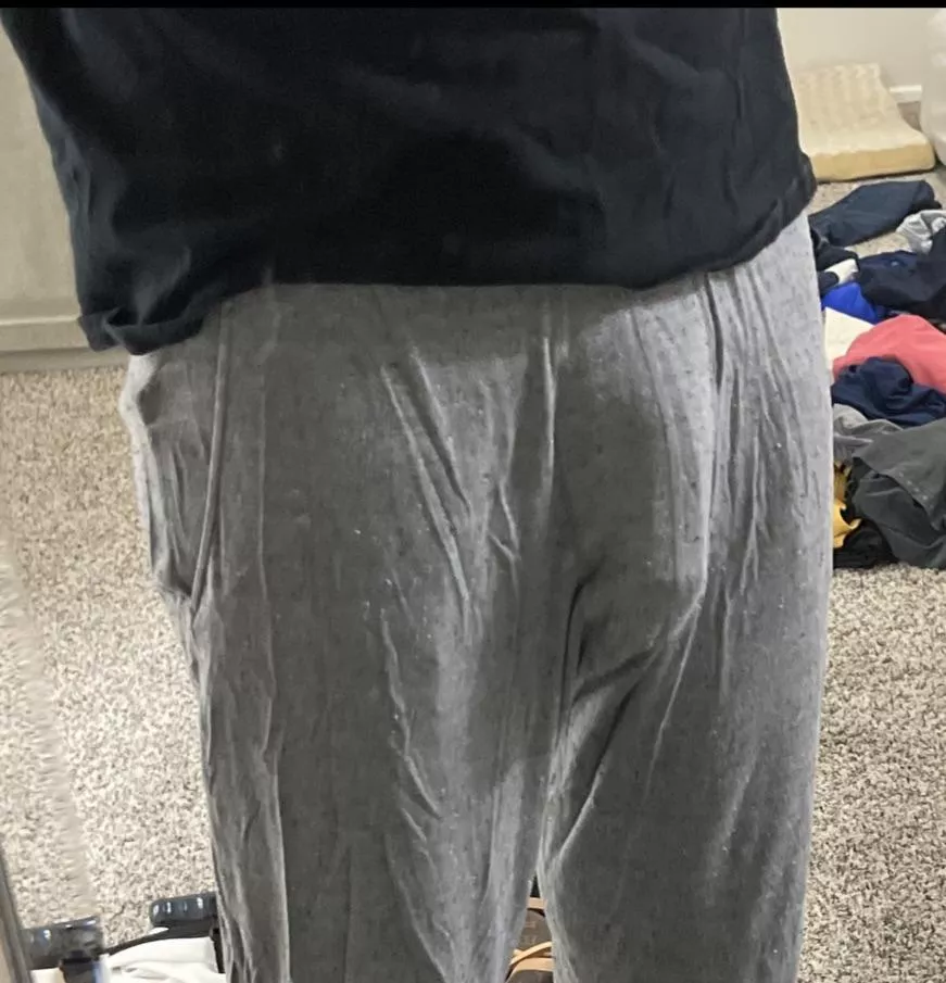 Can’t tell at all right? posted by Flaky-Anywhere-6596