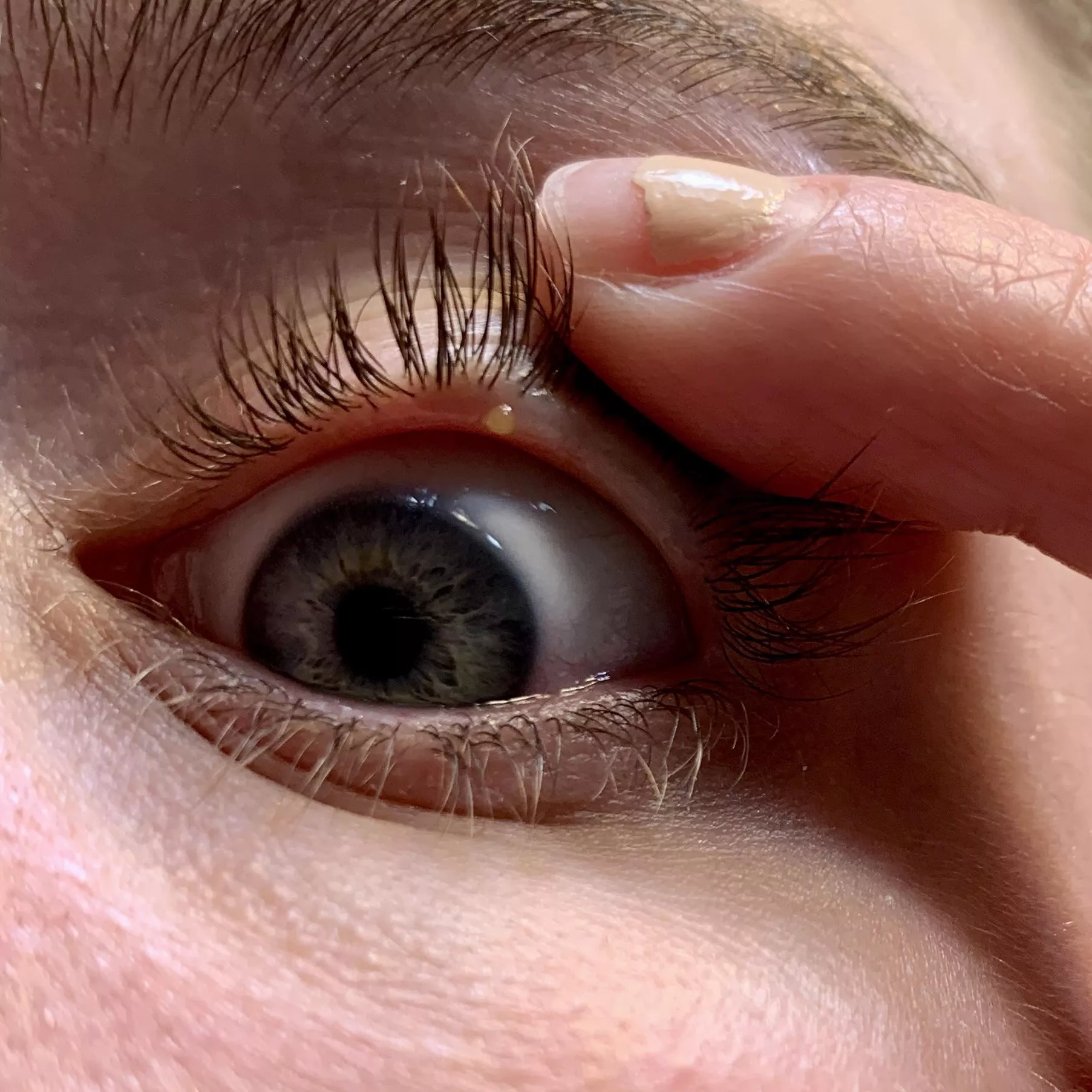 Forbidden pop on the waterline of my eyelid posted by fudgems16