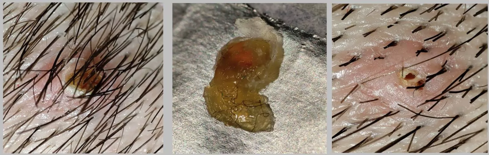 Most satisfying in my life. Just pulled whole thing out. by Andorwar