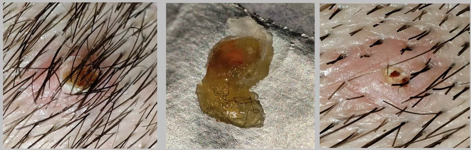 Most satisfying in my life. Just pulled whole thing out. posted by Andorwar