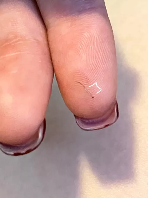 This hair I just plucked and the follicle on it by Becca_jammin