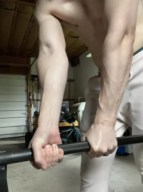 [zombie voice] veeeeiiins by sirmixnowandthen