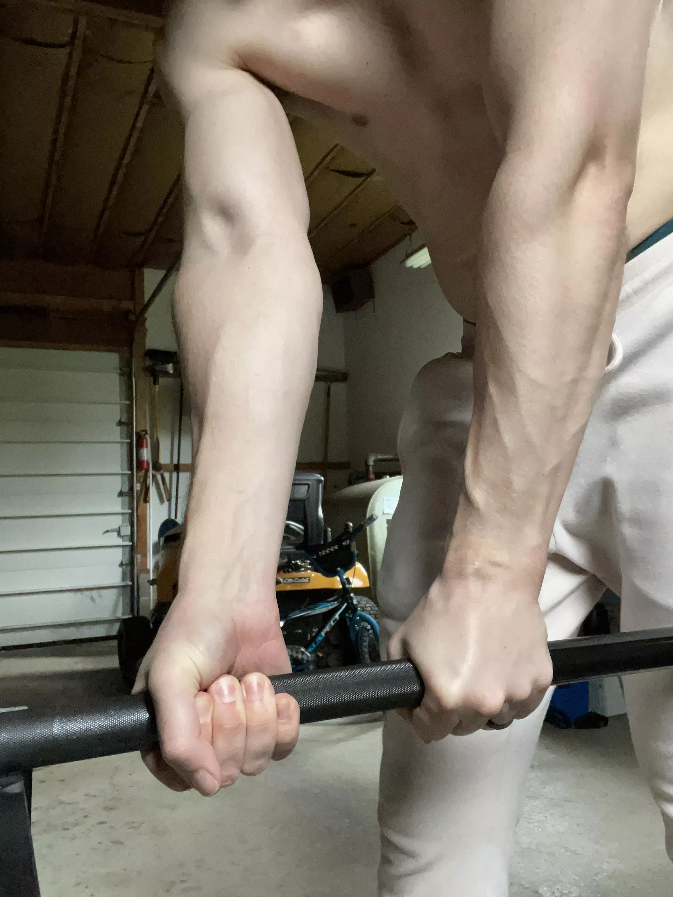 [zombie voice] veeeeiiins posted by sirmixnowandthen