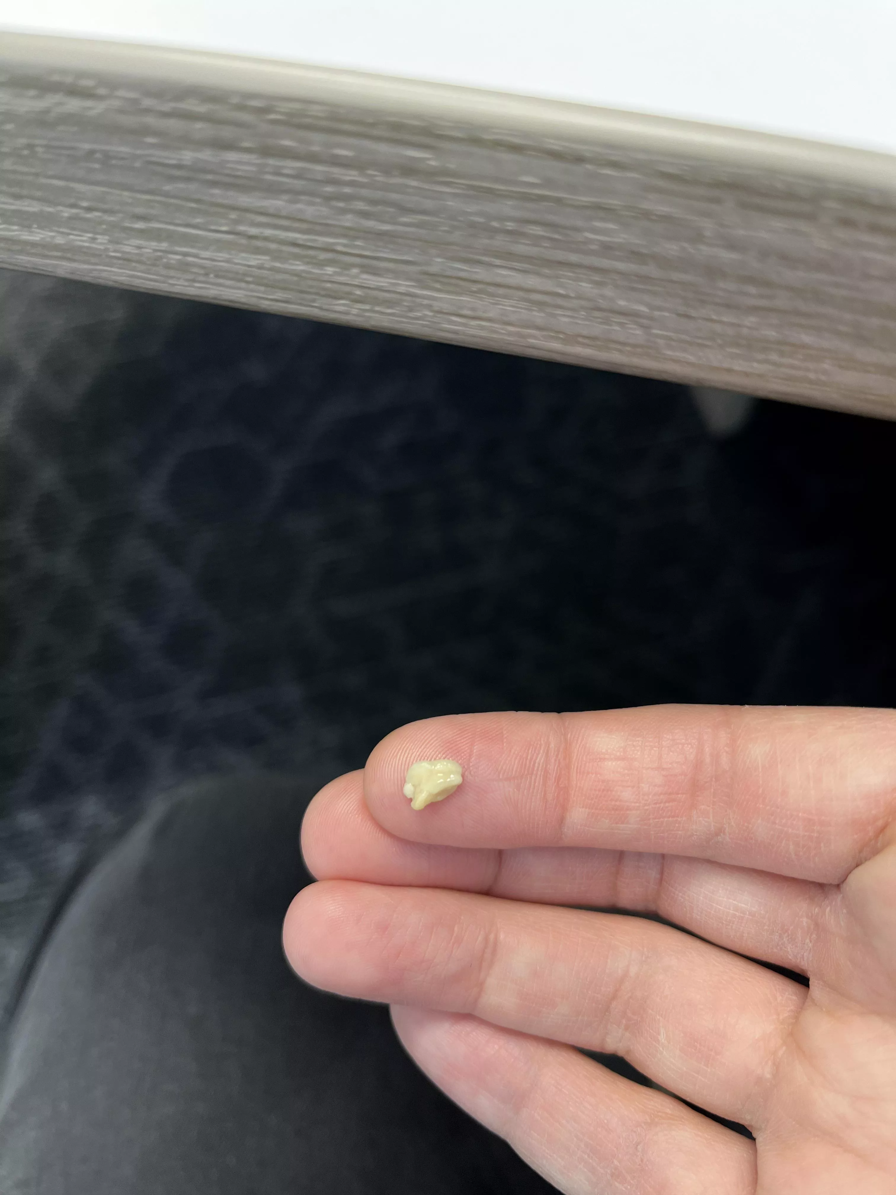 Biggest Tonsil Stone I’ve Had posted by Vince_Crince