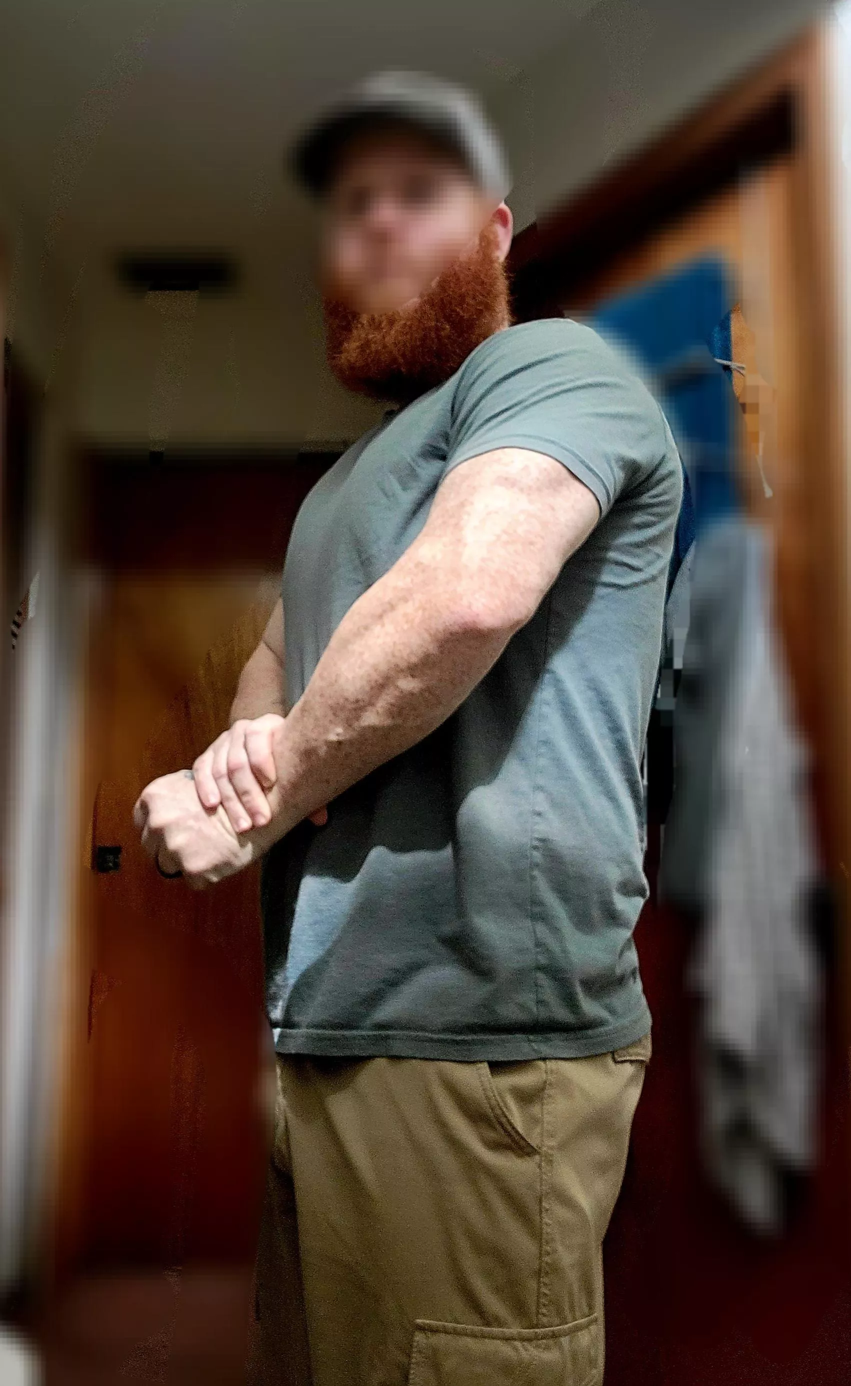 Ginger arms posted by LeprechaunsGold