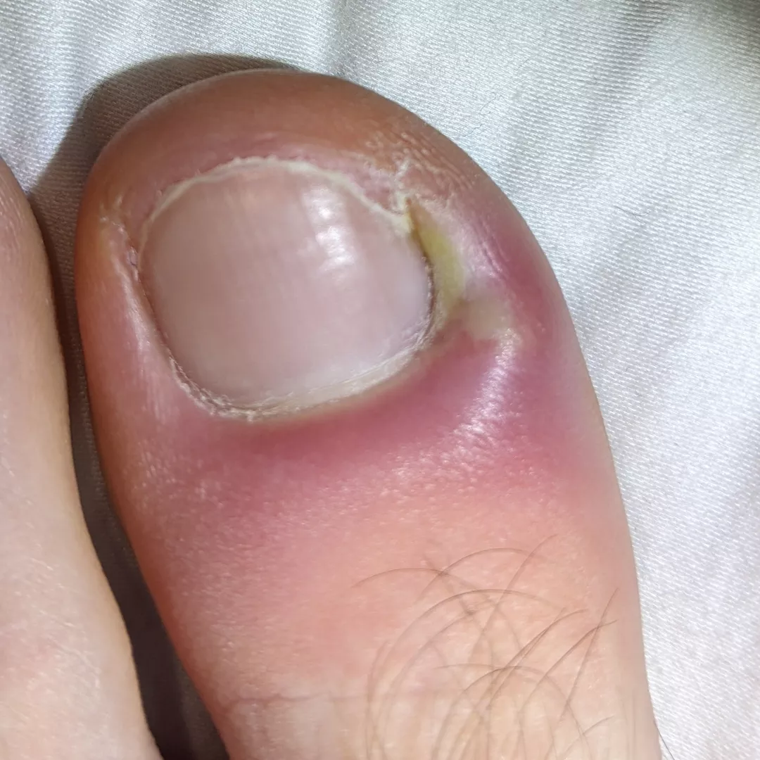 Taking every fibre of my body to not drain this damn thing rn. posted by RushtonIX