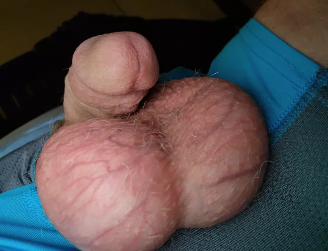 That blood supply! by AmandumVitam